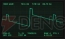 『KORG DSN-12』